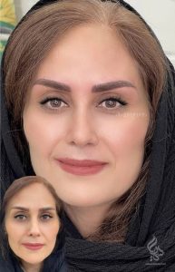 نمونه کار میکروبلیدینگ ابرو