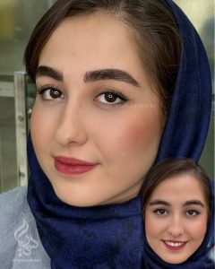 میکروبلیدینگ ابرو