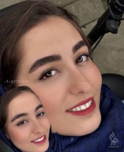 نمونه کار میکروبلیدینگ ابرو