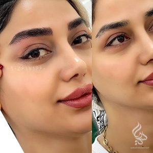 نمونه کار میکروبلیدینگ ابرو